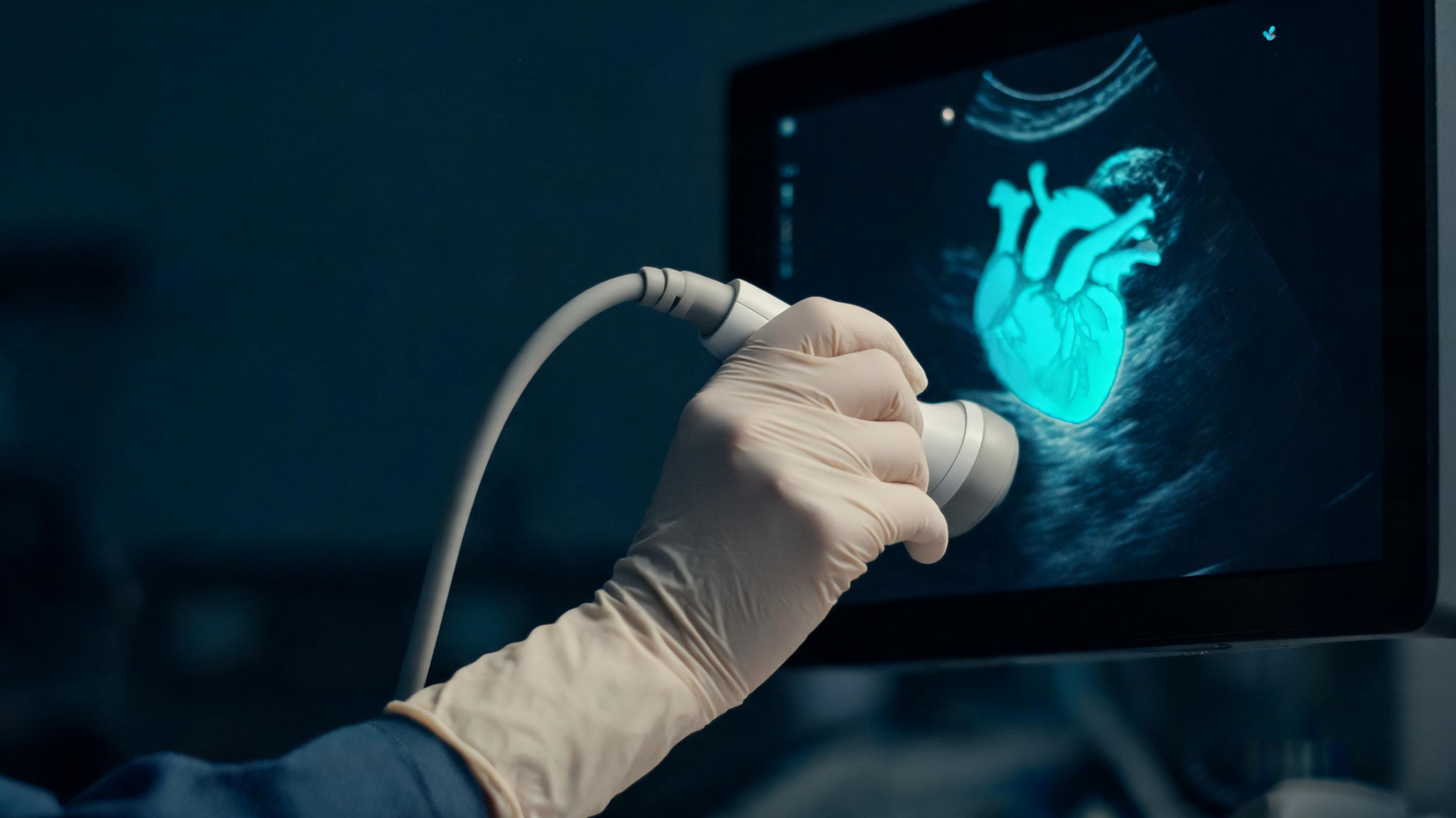 Echocardiogram scan